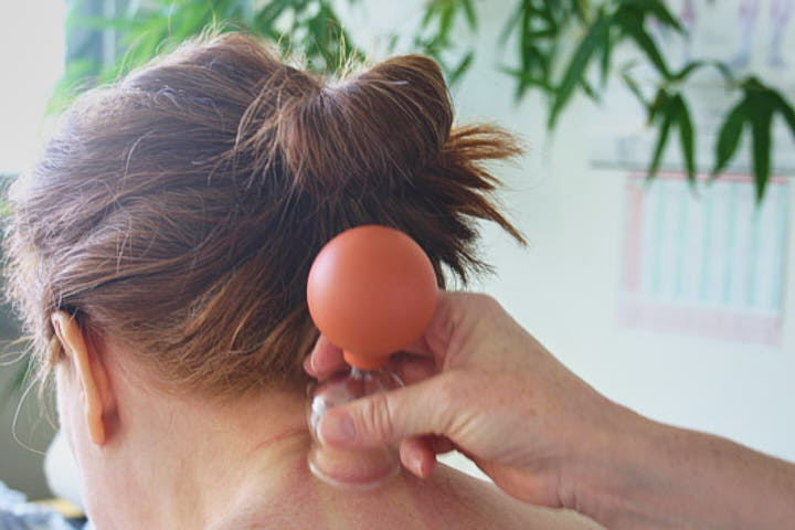 Praxis Dr. Lê-Ruppert - Meckenhein - TCM - Schröpfen